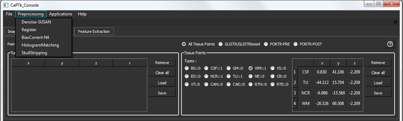 9_preprocessing_resize.png